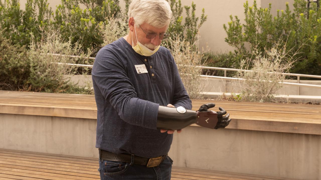 David Brockman, a retired firefighter and hand amputee, shows off his new myoelectric prosthetic device.