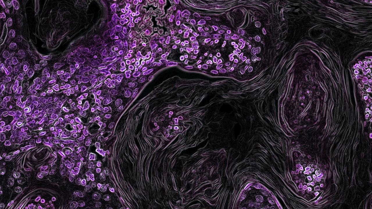purple clusters of cells - abstract