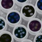 Photo of cultured media in a laboratory